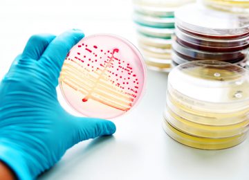 petrischaal microbiologie petrischaal microbiologie